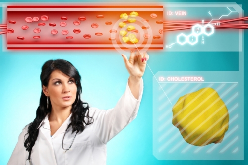 kontrola holesterola